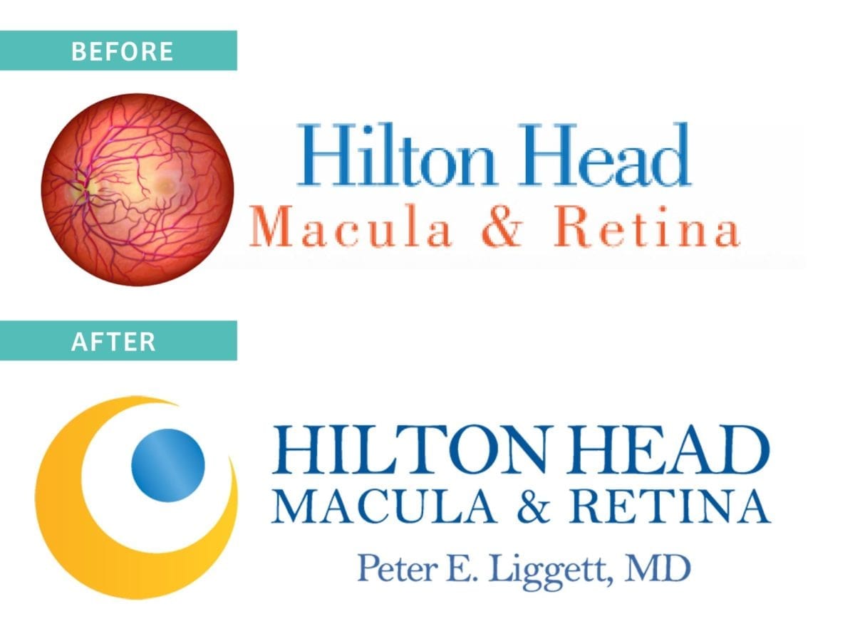 Dr. Peter Liggett hired an online logo company that didn't produce the results he desired. Bragg Media took over the project to create an eye-catching brand that will last a long time for  Hilton Head Macula & Retina